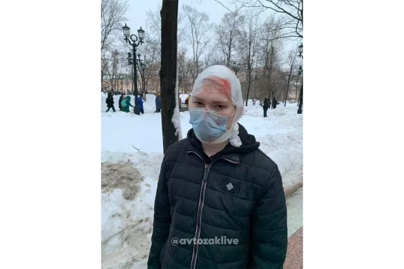 Избитый в Москве на Пушкинской площади / Фото: AvtozakLIVE