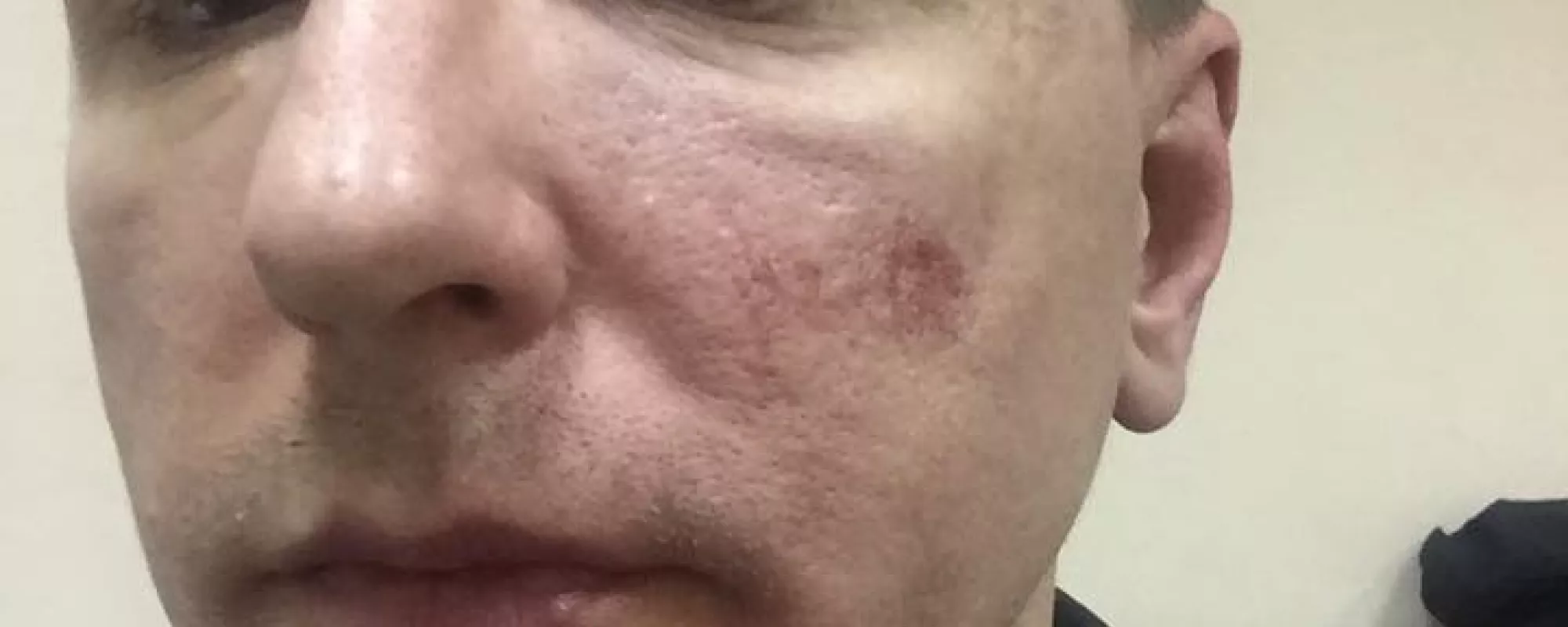 На члена подмосковного ОНК Алексея Павлюченкова напали