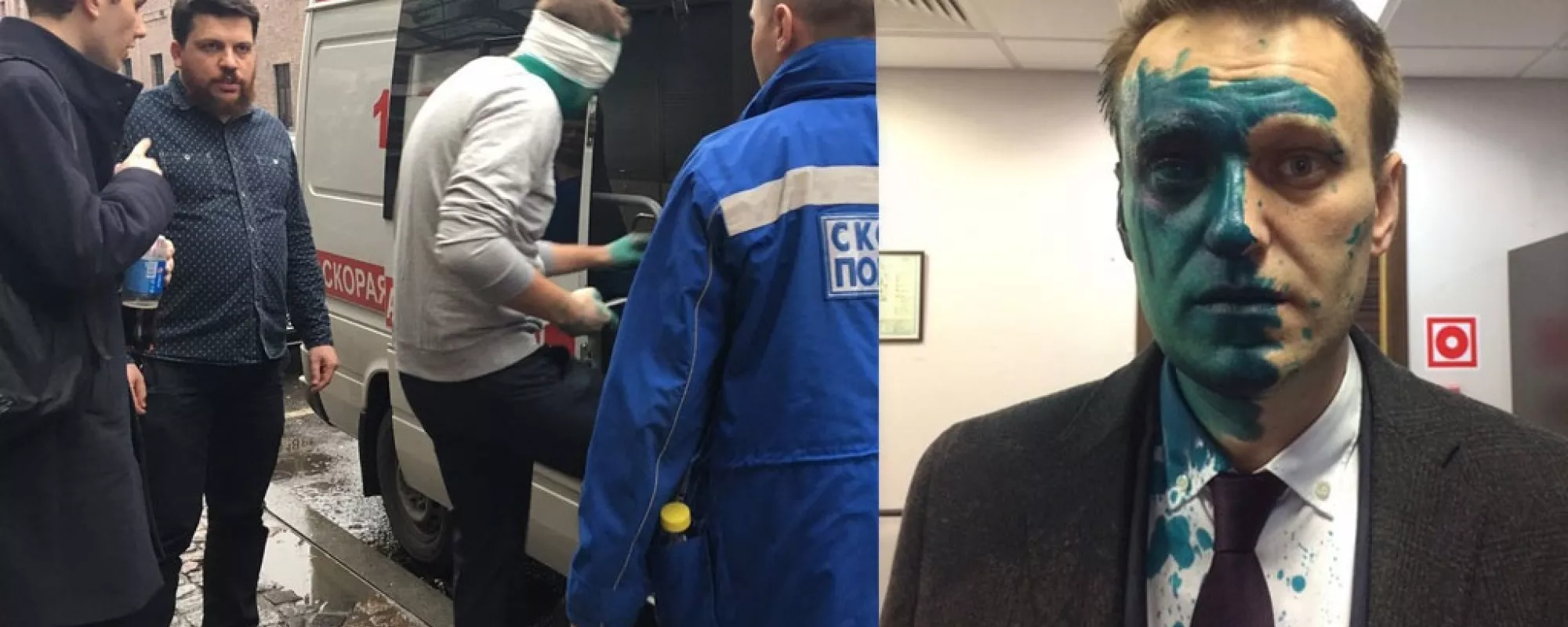 В нападении на Навального могло участвовать четыре человека