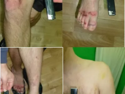  Жалоба на пытки в Нижегородской области дошла до Страсбурга 