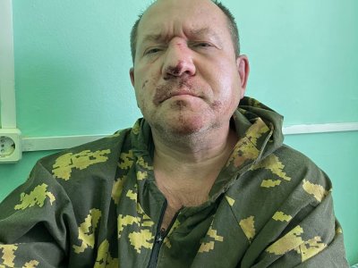 Игорь Каляпин после нападения / Фото: телеграм-канал «Команды против пыток»